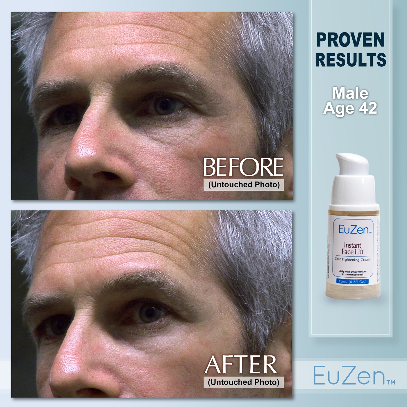 Man, age 42, before and after EuZen application